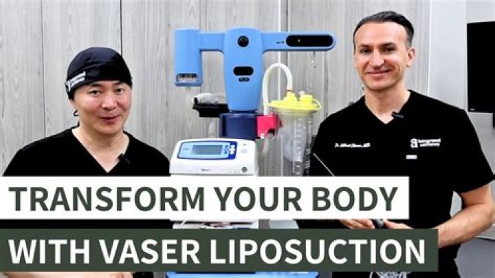 Expert Liposuction By Peter: Transform Your Body Today