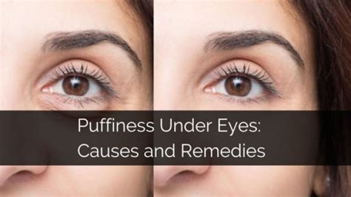Protect Your Skin: Hisashi Skin Falling Off, Causes And Remedies