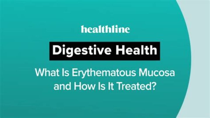 Understand Erythematous Mucosa: Causes, Symptoms, And Treatment