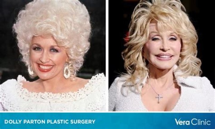 Unveiling Dolly Parton's Plastic Surgery Secrets: Exploring The Extent Of Her Enhancements